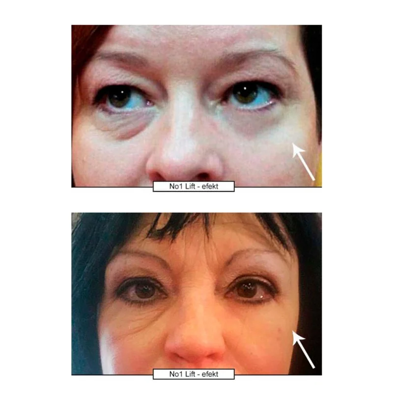 No.1 Lift Eye Cream 15 ml