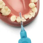 Normal Interdental Brushes 0.6 mm 8 pcs