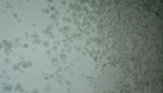 Effective Methods to Combat Mold on Walls