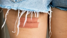 Effective and Natural Methods for Treating Purulent Wounds