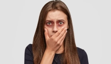 How to Treat Bruises Using Proven Natural Methods