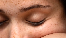 Why do brown spots appear on the skin and how to prevent them?