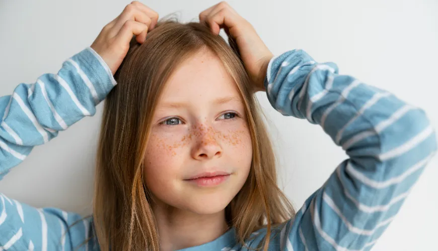 A Practical Guide to Removing Nits from Hair